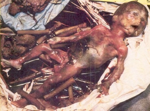Pictures Aborted Babies